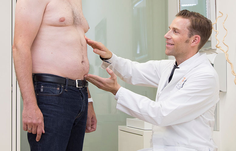 Bauchdeckenstraffung beim Mann - Adominoplastik Beta Plastische Chirurgie Bonn