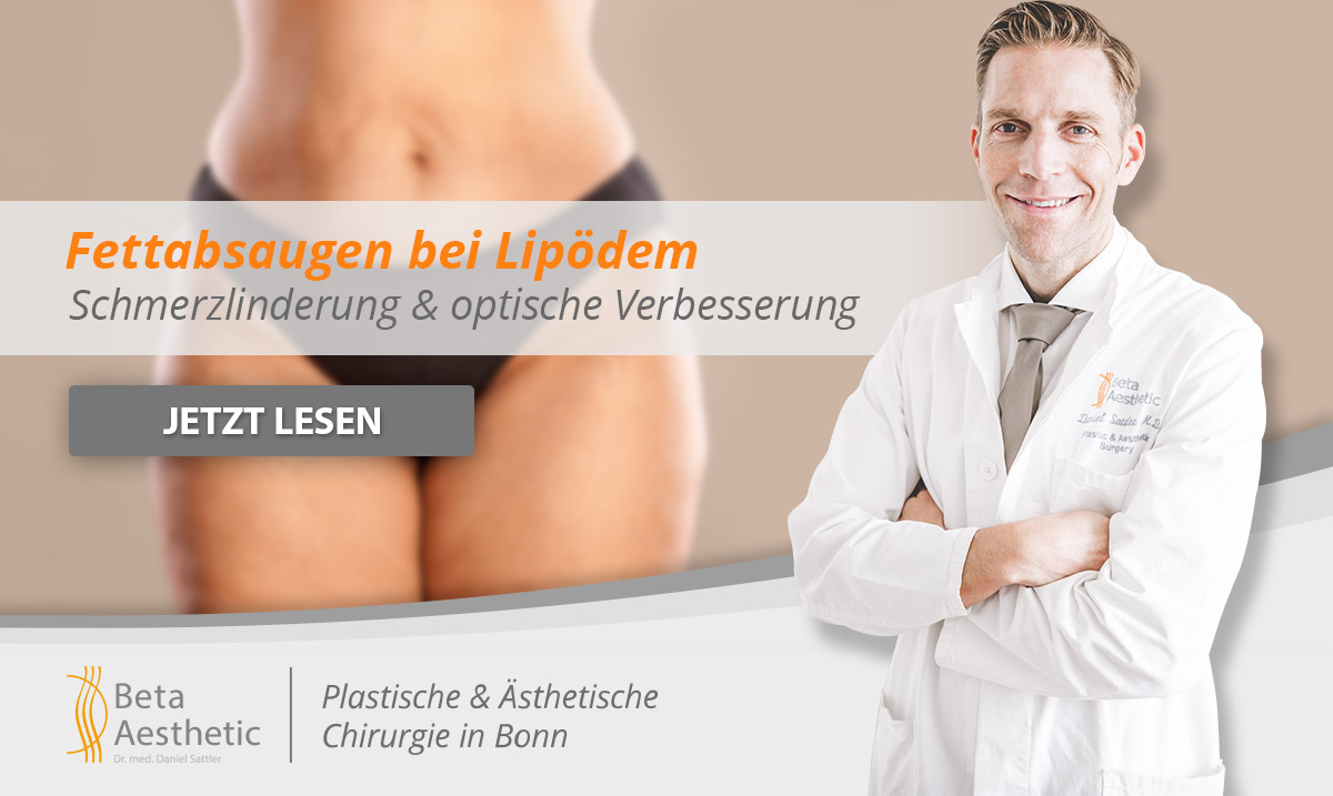 fettabsaugen-bei-lipoedem fettabsaugen lipoedem