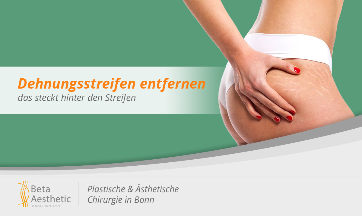 dehnungsstreifen-entfernen-in-bonn-das-steckt-hinter-den-streifen-und-so-wird-man-sie-los