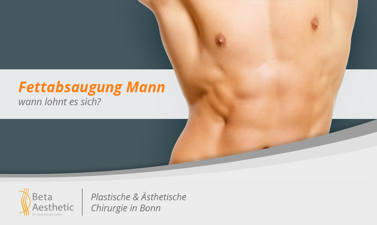 fettabsaugung-beim-mann-wann-lohnt-es-sich