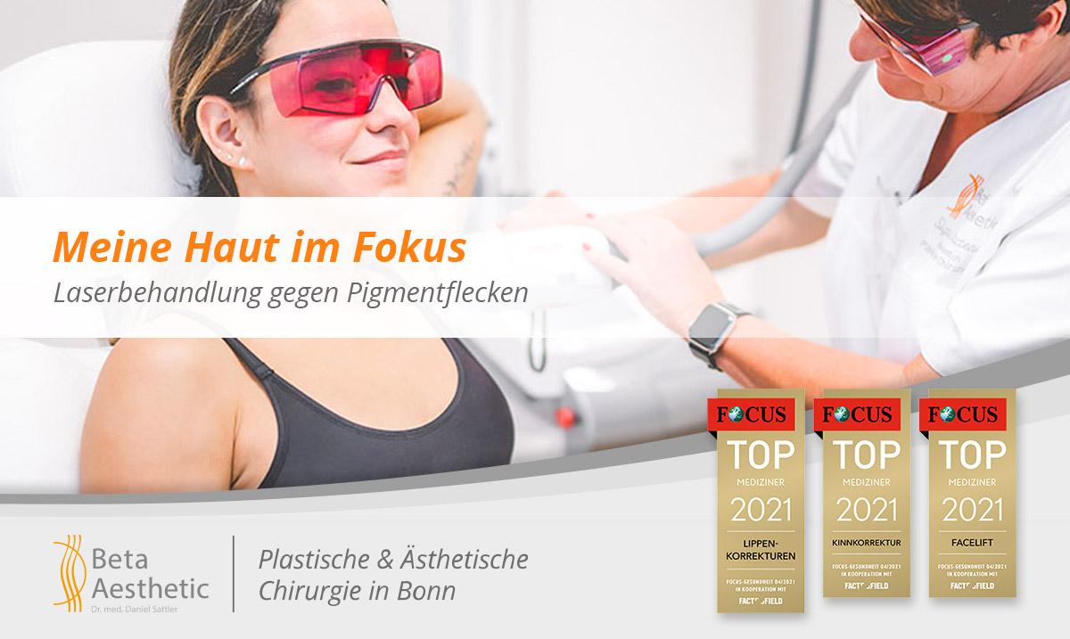 laserbehandlung-gegen-pigmentflecken