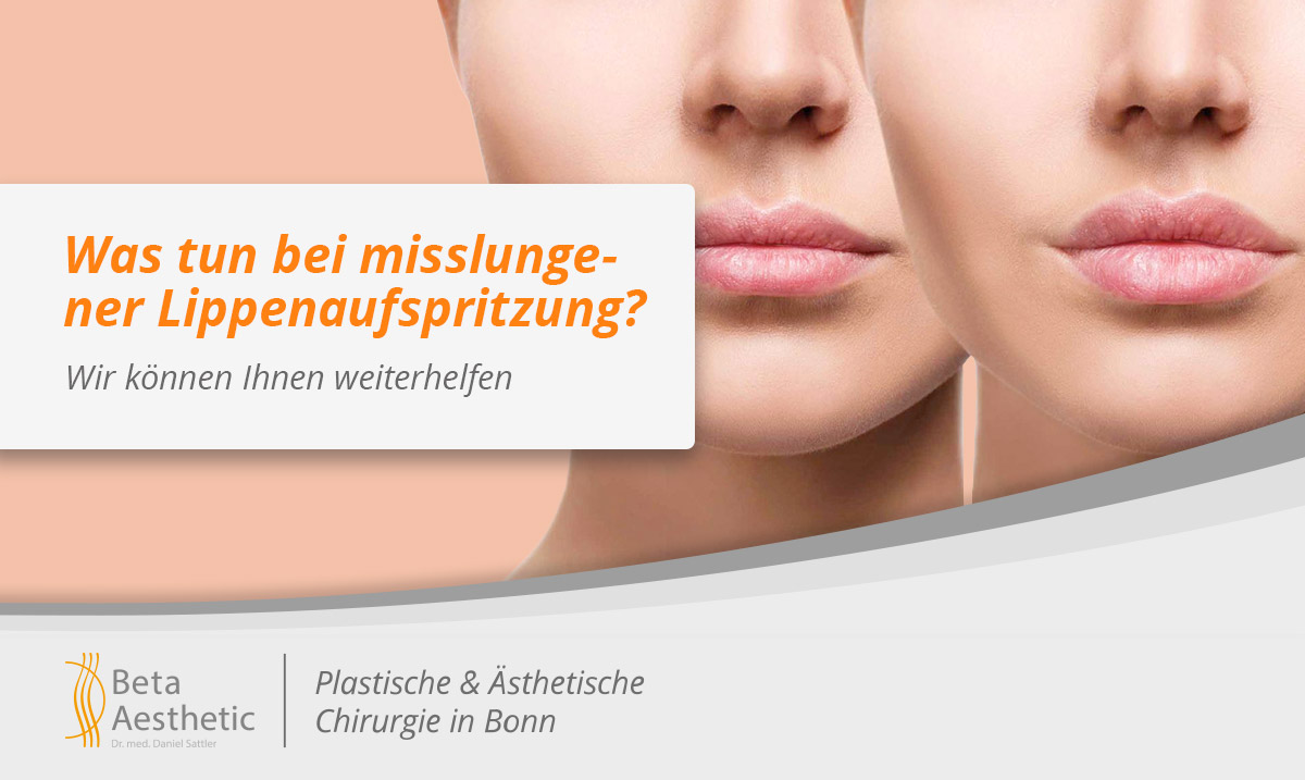 was-tun-bei-misslungener-lippenaufspritzung