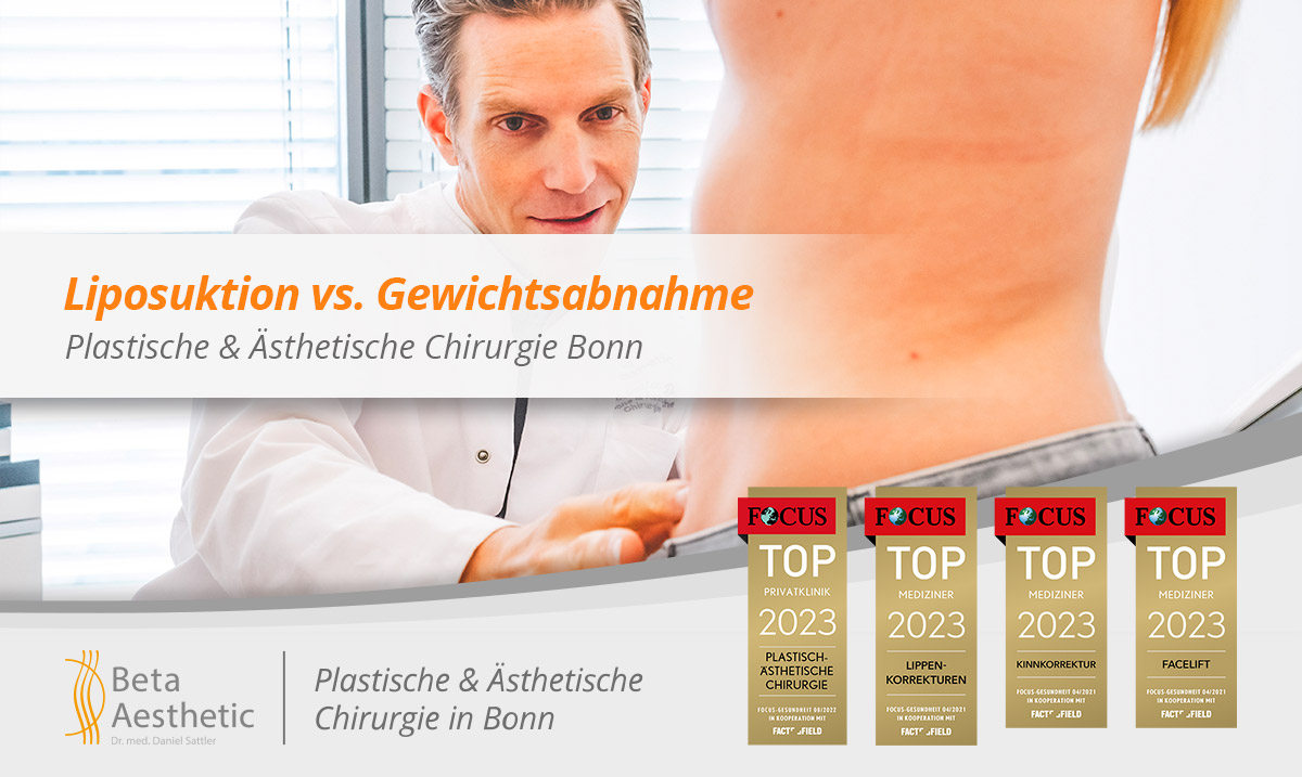liposuktion-vs-gewichtsabnahme