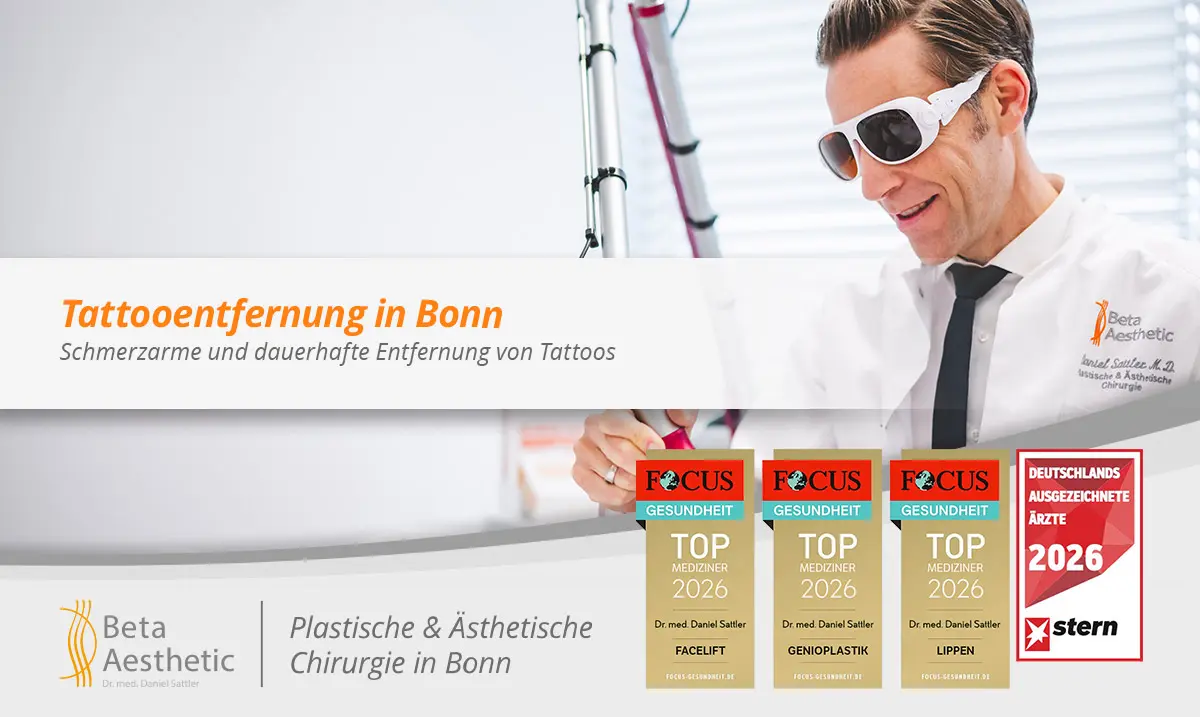 tattooentfernung-in-bonn